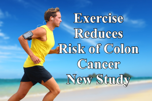 Exercise Colon Cancer Survival: Key Findings for Patients