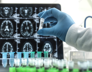 Alzheimer’s Research: Discovering Solutions Through Science